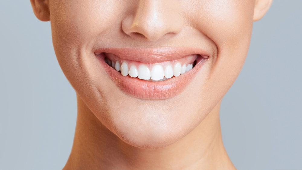 Teeth Whitening College Station